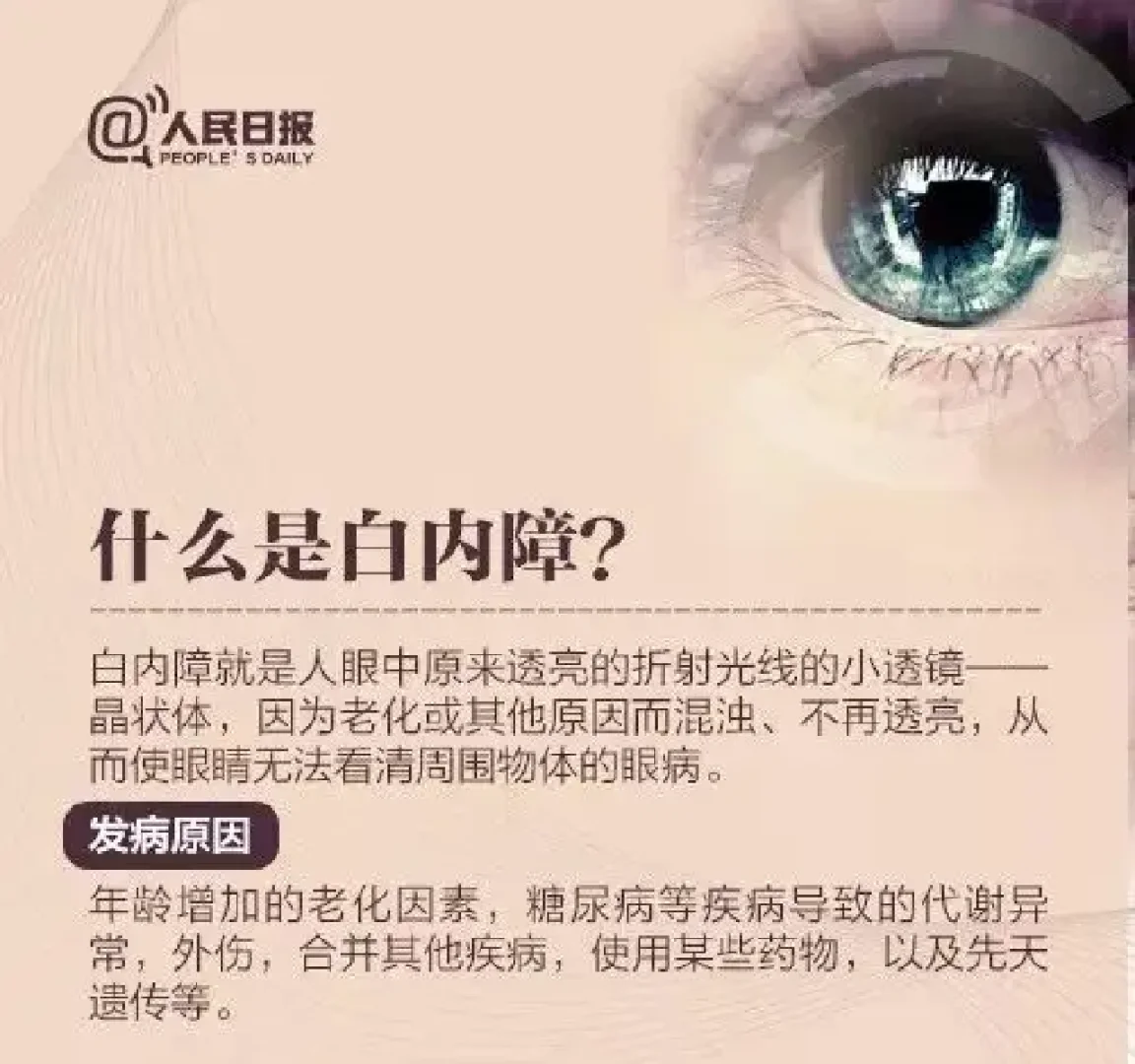 白内障的原因-先天性白内障的原因