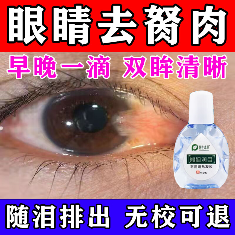 翼状胬肉-(翼状胬肉是什么意思)
