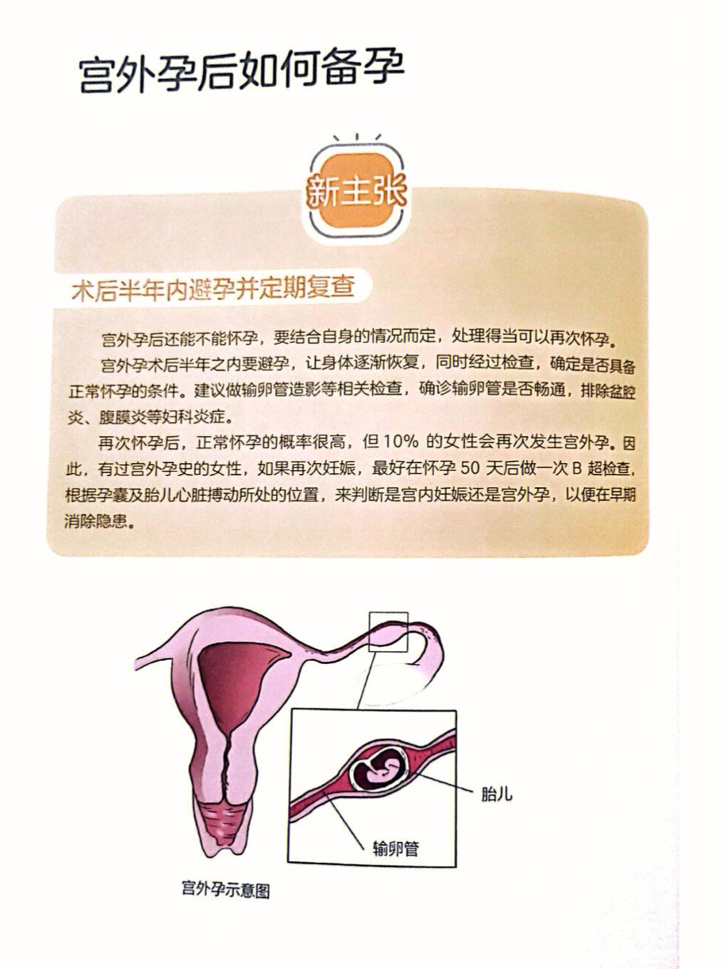 宫外孕可以吃药打掉吗-宫外孕可以吃药打下来吗