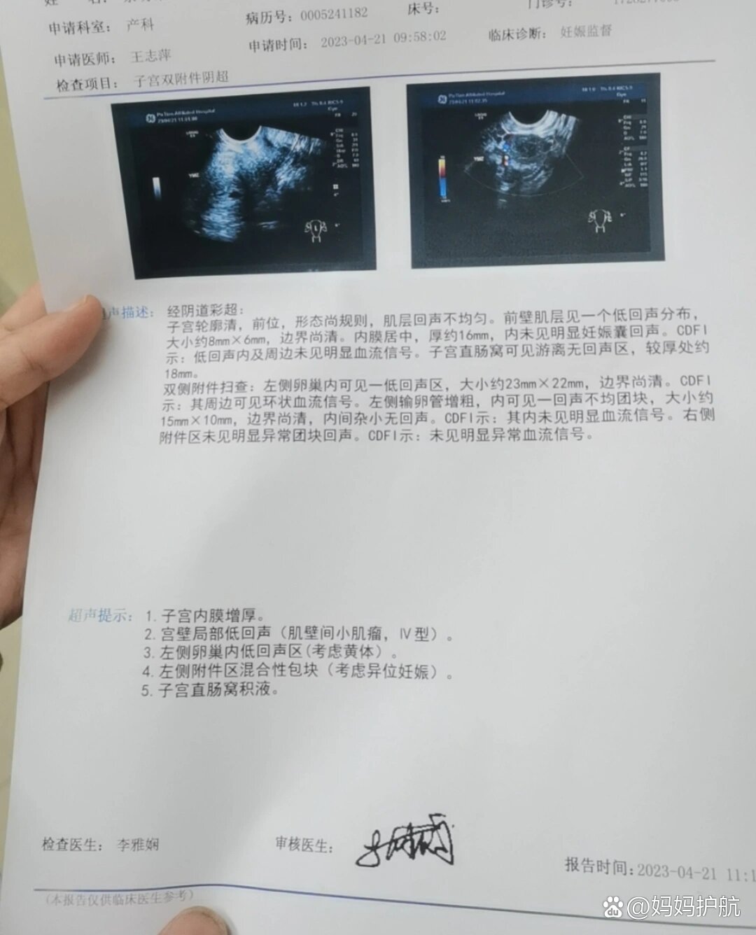 宫外孕手术要多久(宫外孕手术要多久才能恢复)