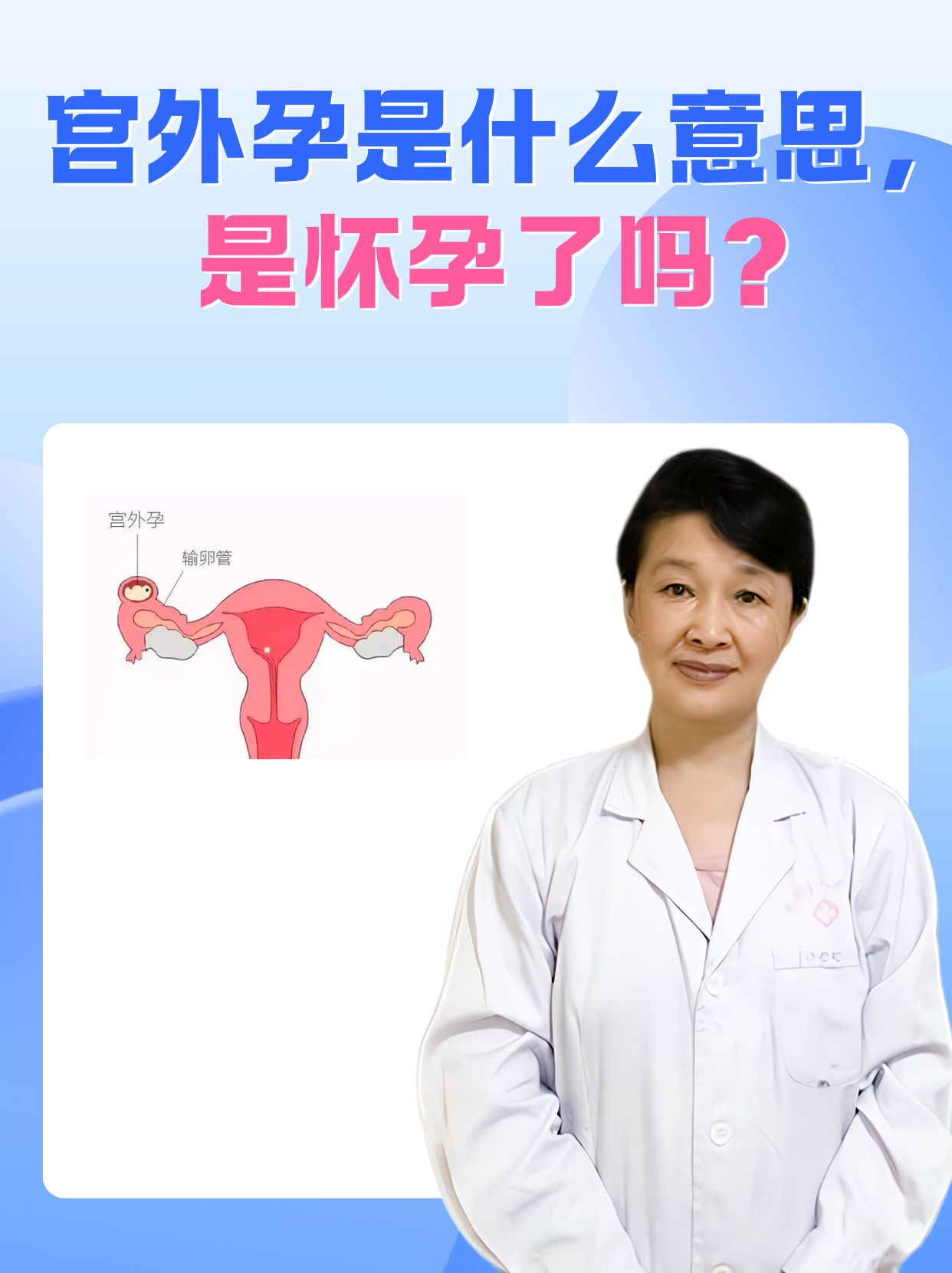 宫外孕是什么(宫外孕是什么原因造成的怎么治疗)