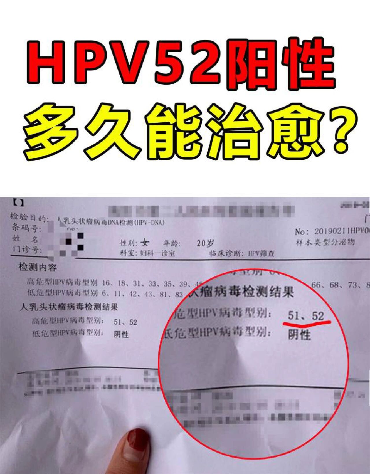 hpv52高危阳性是什么意思-hpv52高危型阳性是什么意思