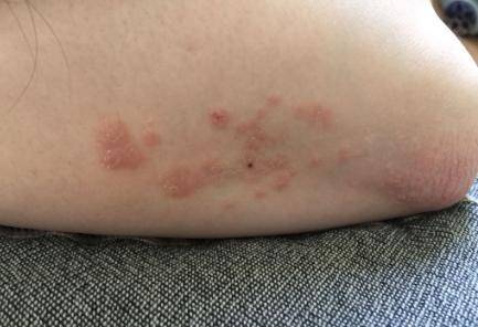 艾滋病携带者(艾滋病携带者一般可以存活多少年)