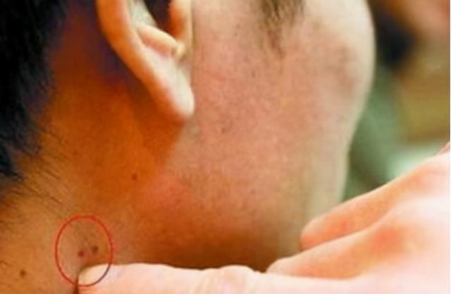 艾滋病携带者(艾滋病携带者一般可以存活多少年)