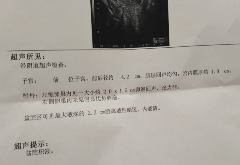 子宫直肠窝积液-子宫直肠窝积液多少mm算正常范围