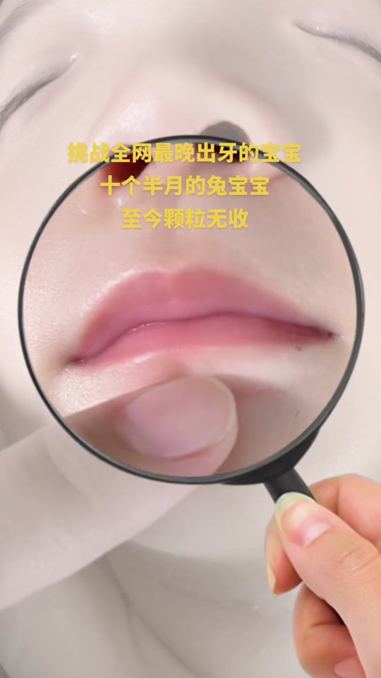 哺乳期可以补牙齿吗-哺乳期可以补牙齿吗小孩感冒了怎么办