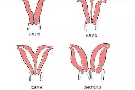 子宫图片-子宫图片正常的图位置图 结构图