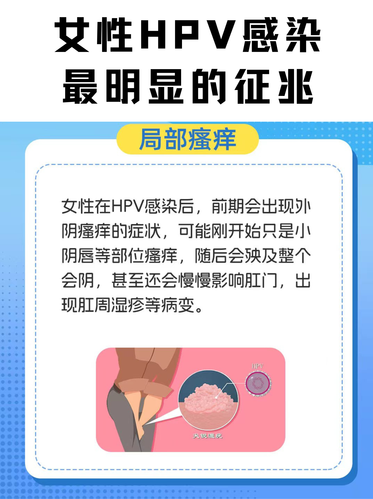 女性hpv最明显的征兆-(女性hpv最明显的征兆 及 治疗)