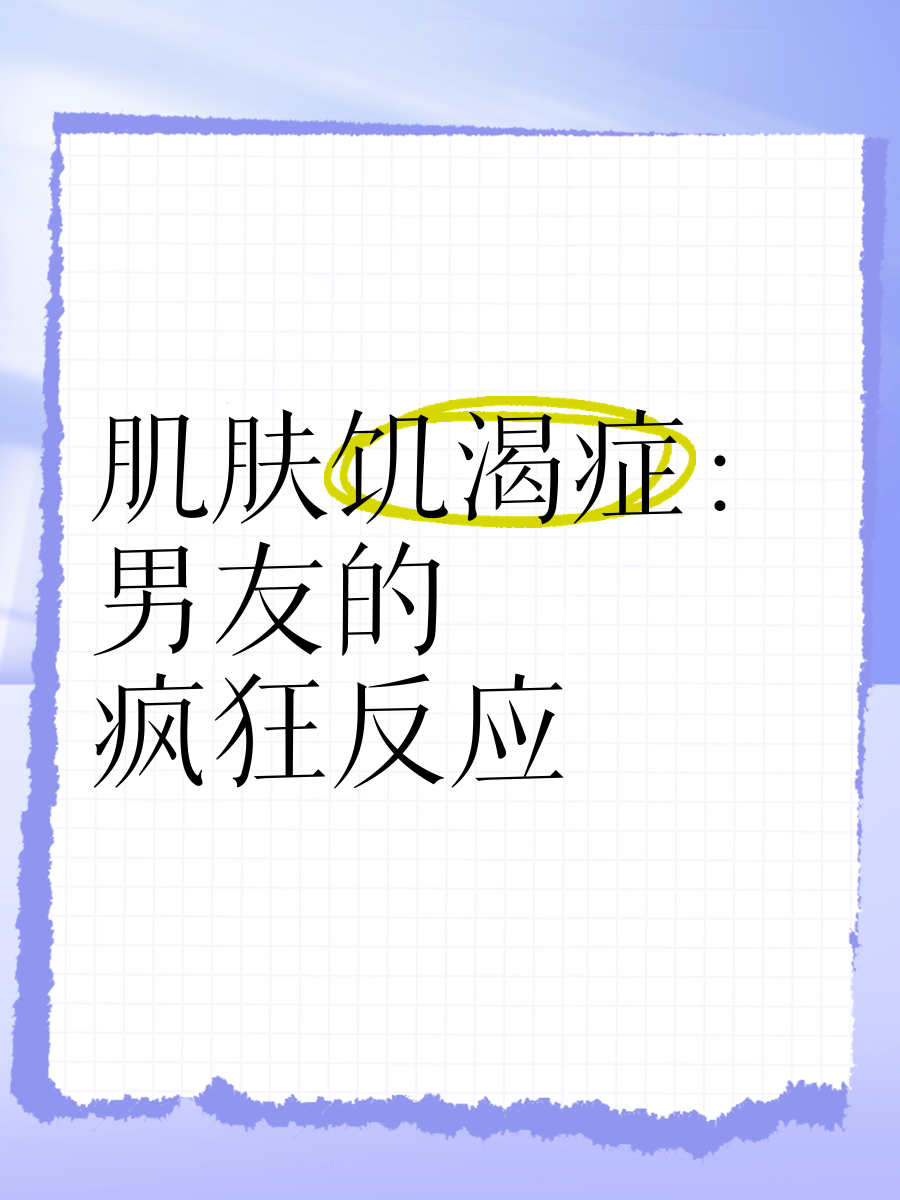 渴肤症(渴肤症哭包的贴贴指南小说)