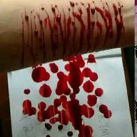 自残(自残的孩子是什么心理疾病)