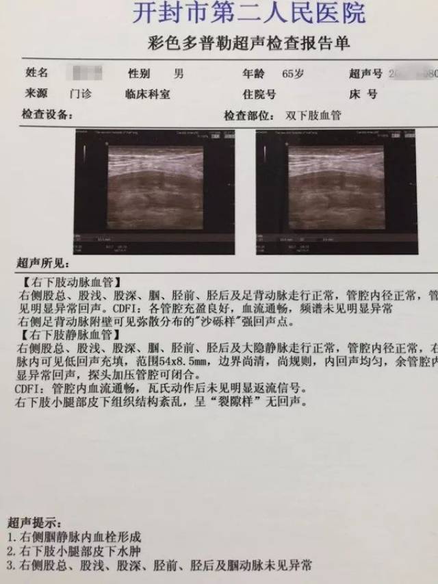 下肢血管彩超(下肢血管彩超主要检查什么)