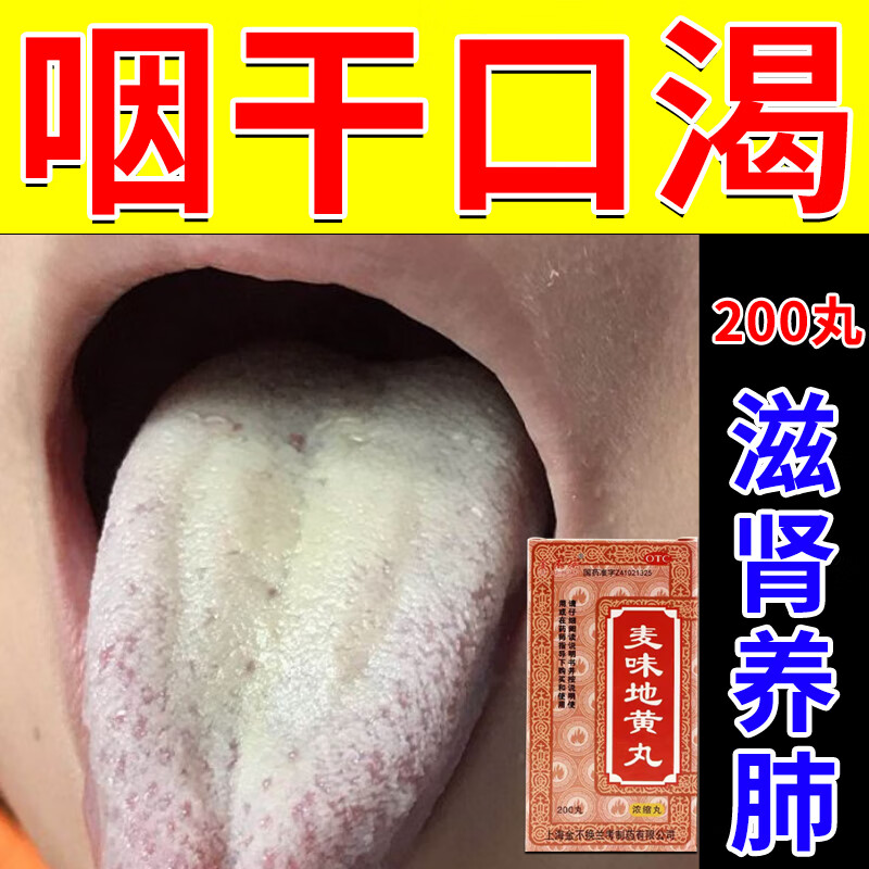 咽干吃什么药-口干咽干吃什么药