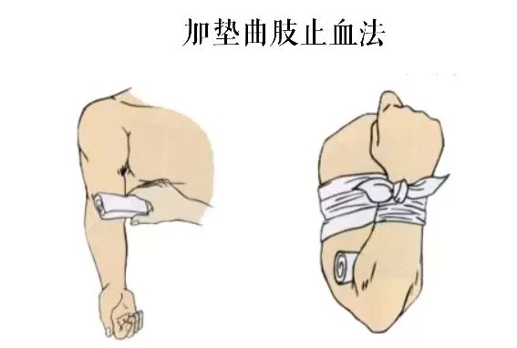 止血包扎-止血包扎常用的材料不包括