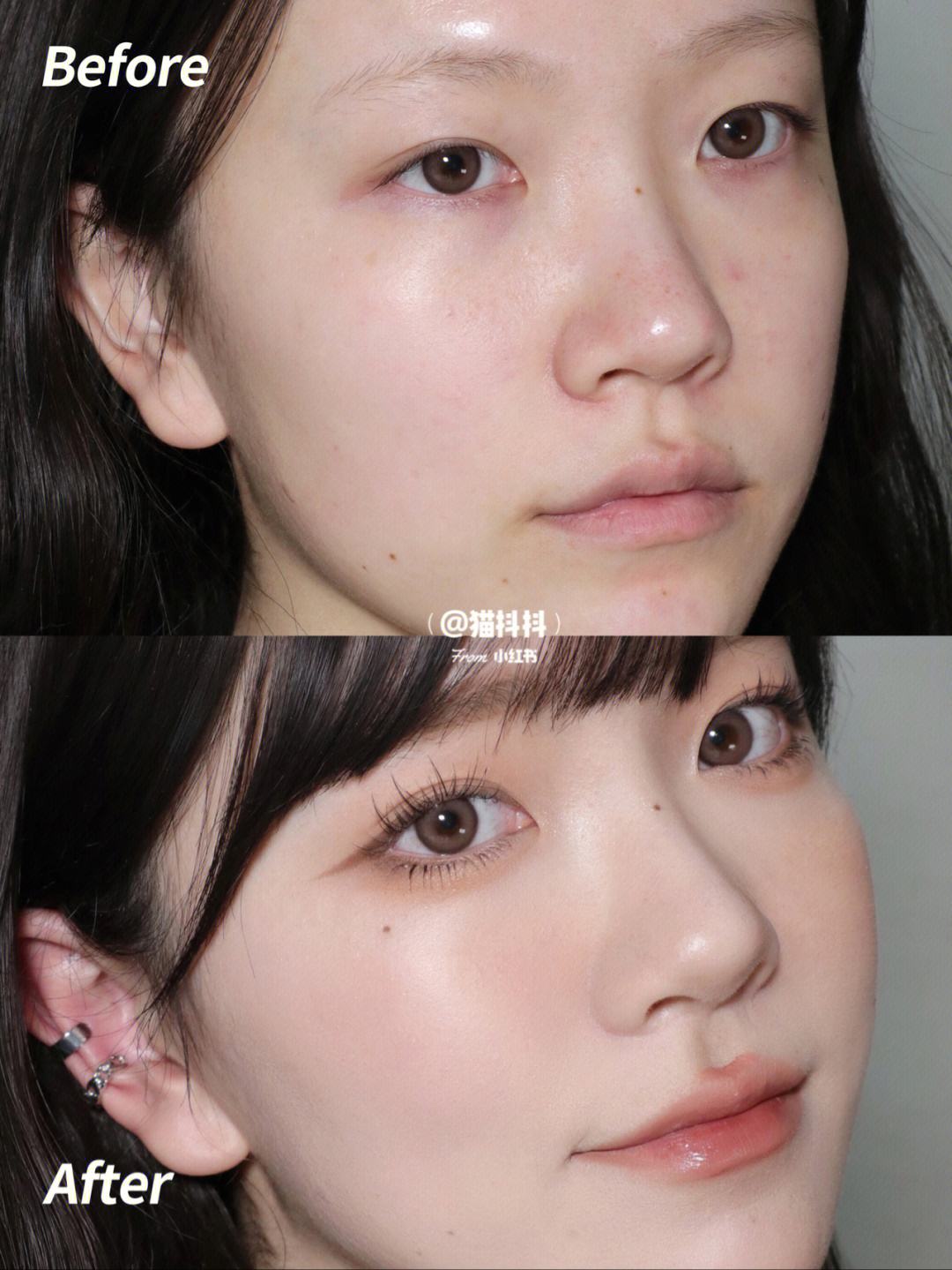 混干皮是什么特征-混干皮是什么类型的皮肤