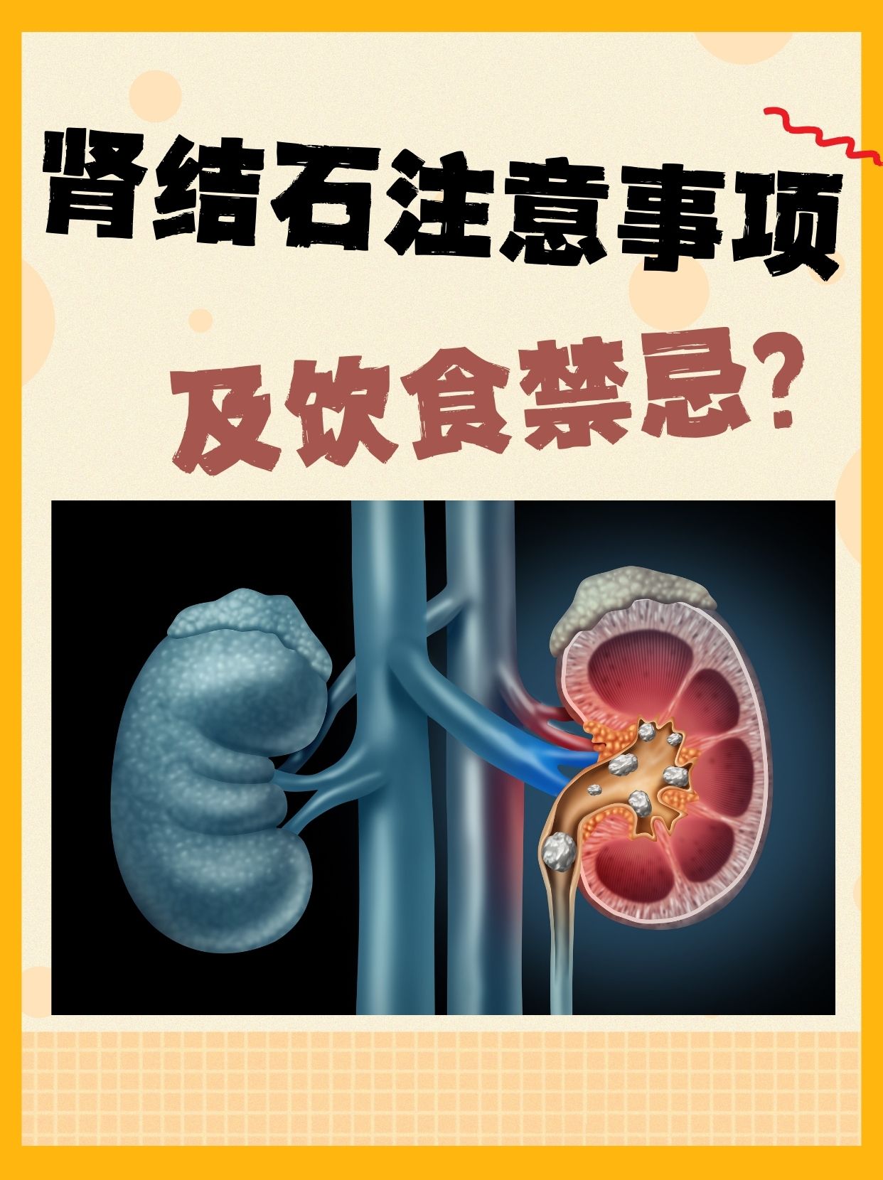 肾结石挂什么科室(小儿肾结石挂什么科室)