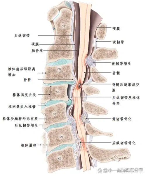 颈椎病做什么检查-(脊髓型颈椎病做什么检查)