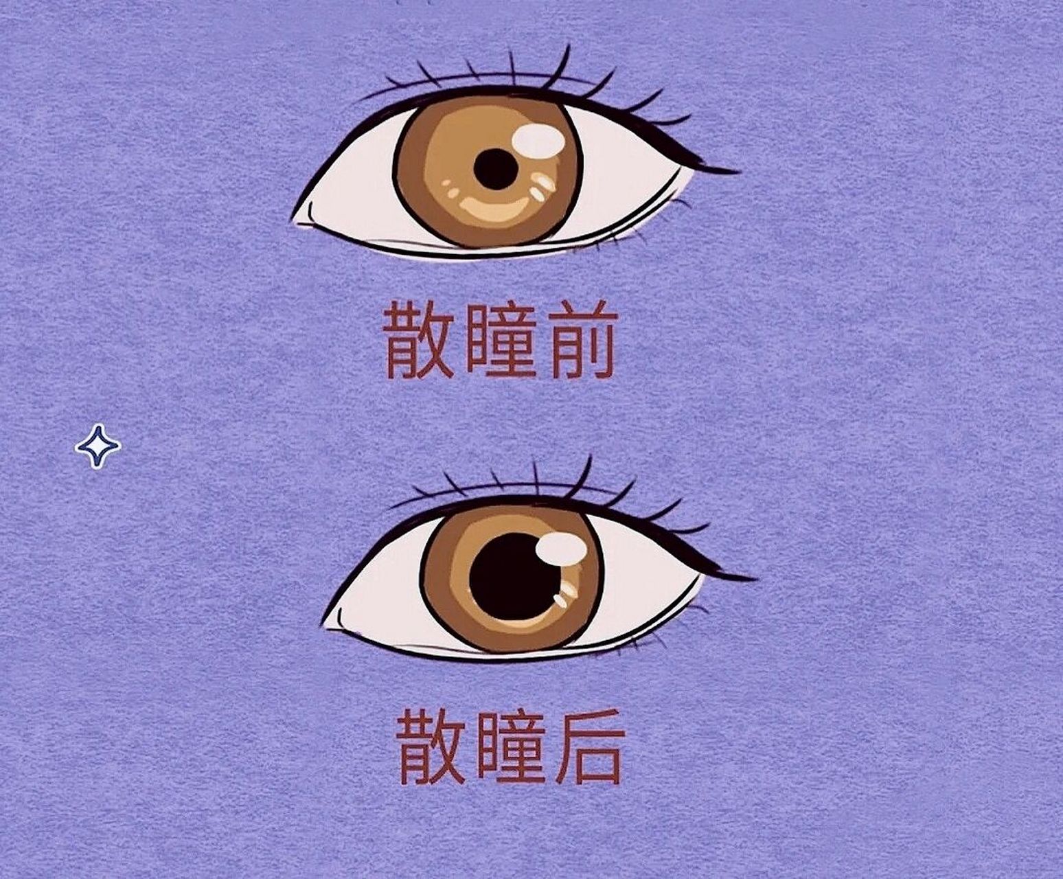 瞳孔散大的原因(右眼瞳孔散大的原因)