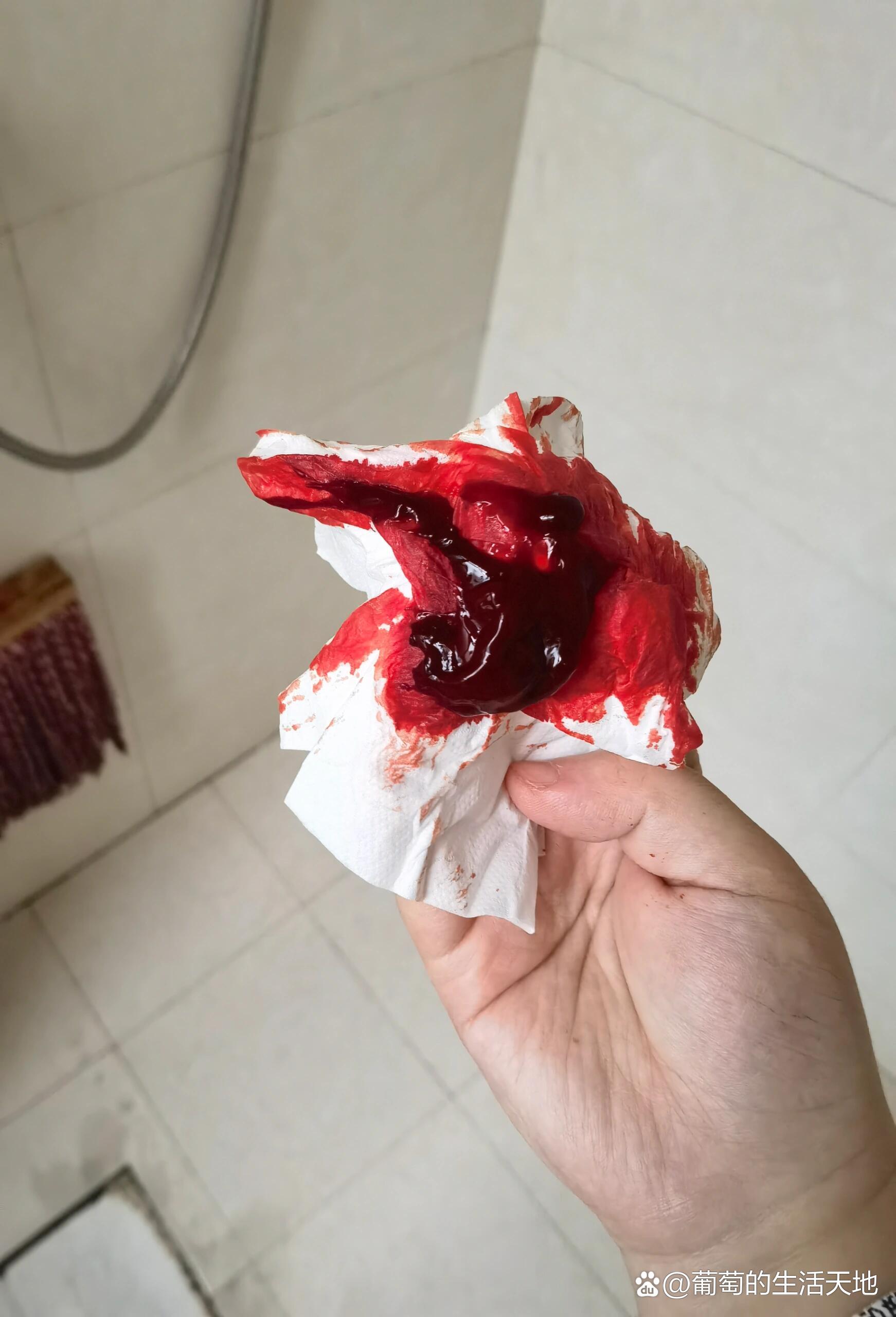 滑胎和流产的区别-一次喝了10袋益母草流产了