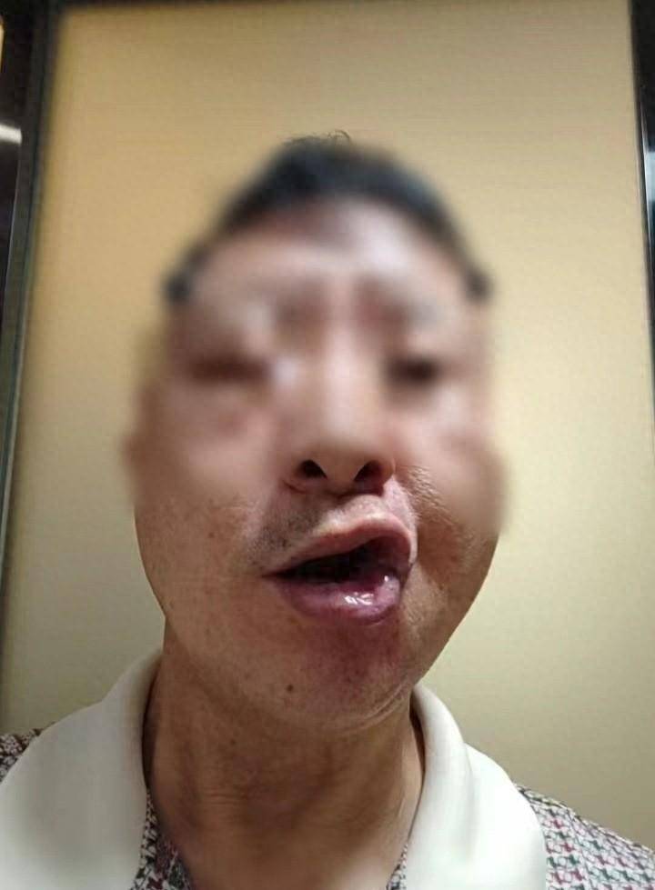 脑痉挛的症状-(脑痉挛的症状及治疗方法吃什么药)