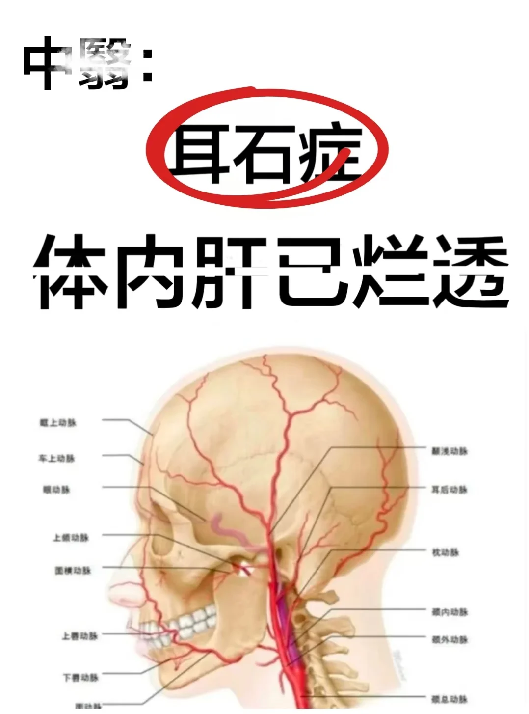 耳石症好治吗(耳石症好治吗需要多少钱)