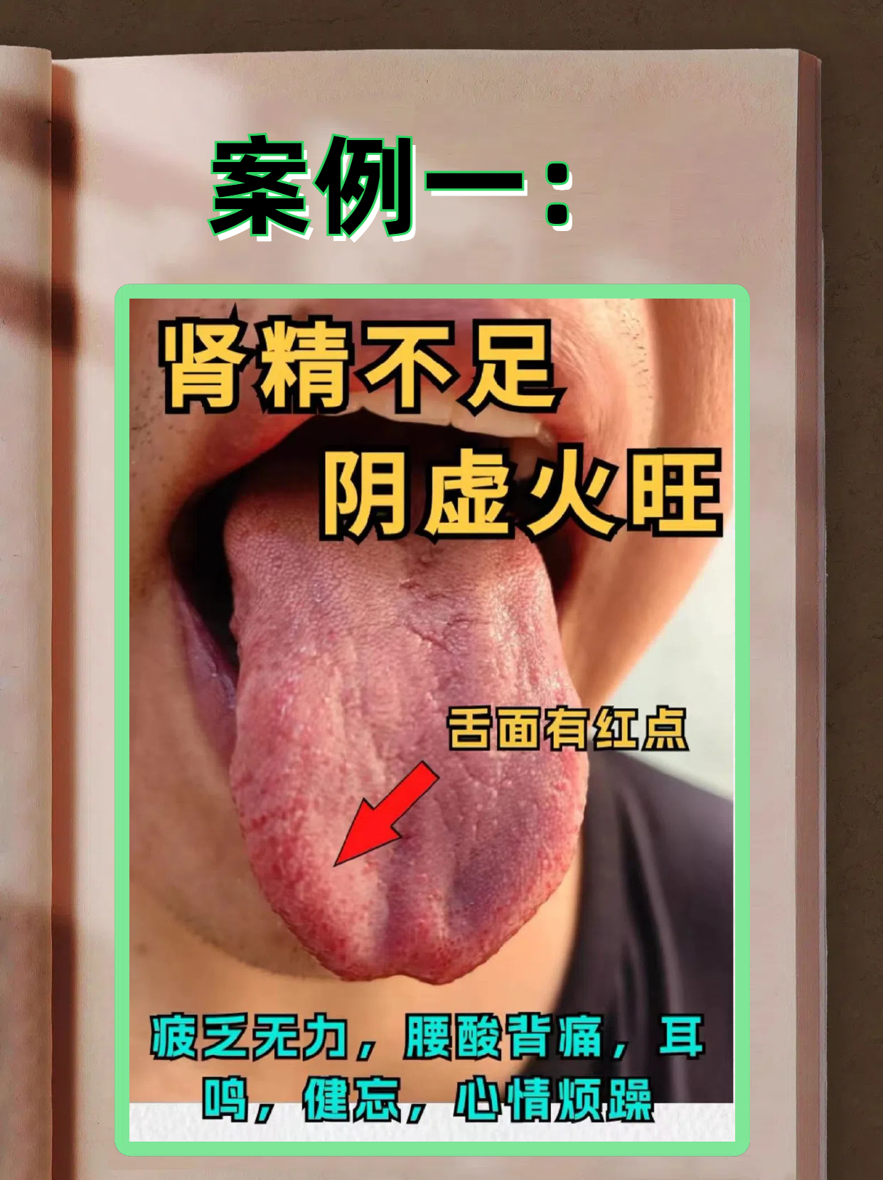 心开窍于舌(心开窍于舌其华在面是什么意思)