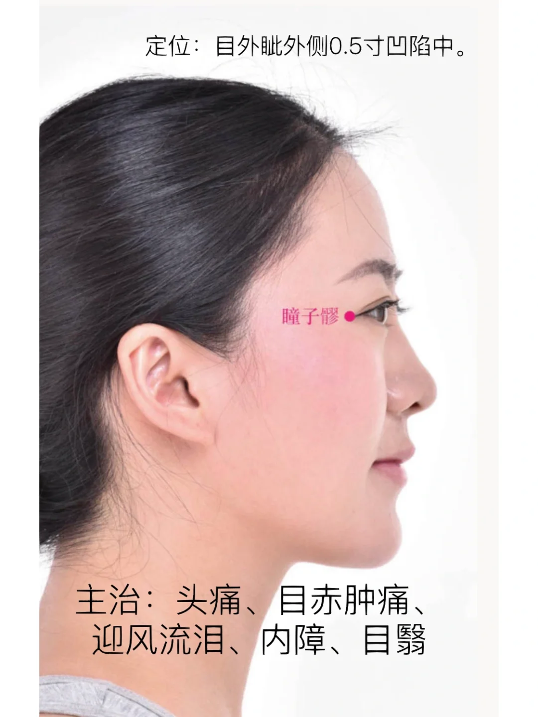 目翳-目翳是什么症状