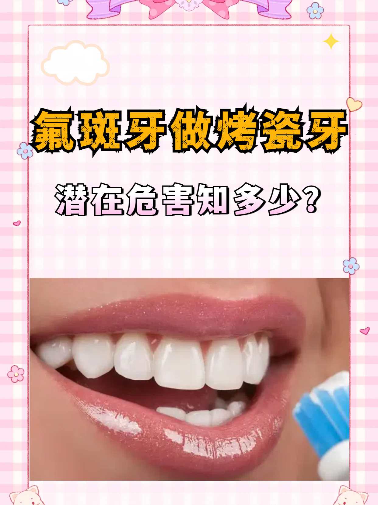烤瓷牙的危害(无铍无镍烤瓷牙的危害)