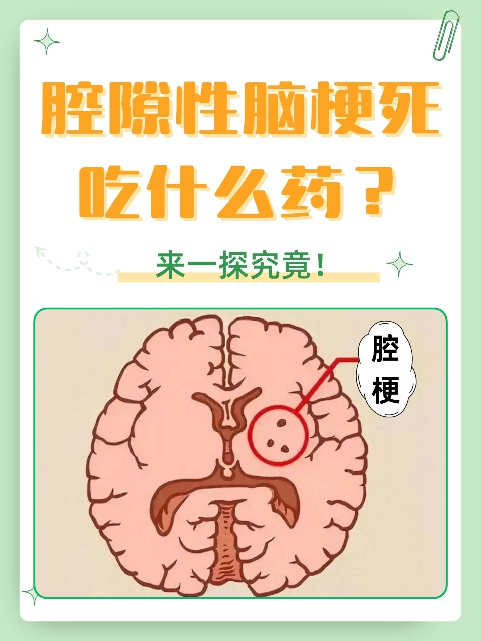 突发脑梗怎么办-(老人突发脑梗怎么办)