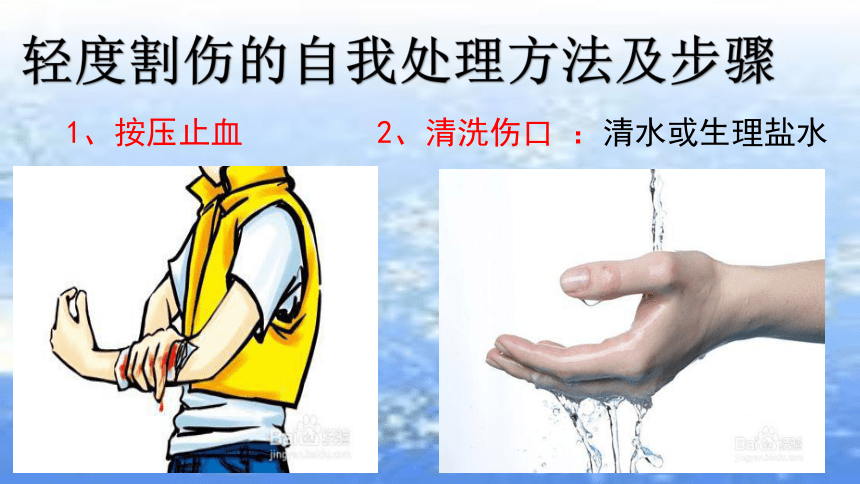 擦伤怎么处理-(面部擦伤一般几天能好)