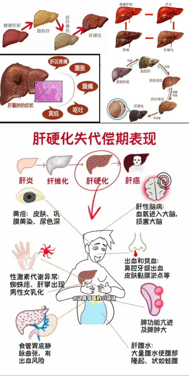 慢性肝炎严重吗(慢性活动性肝炎严重不)