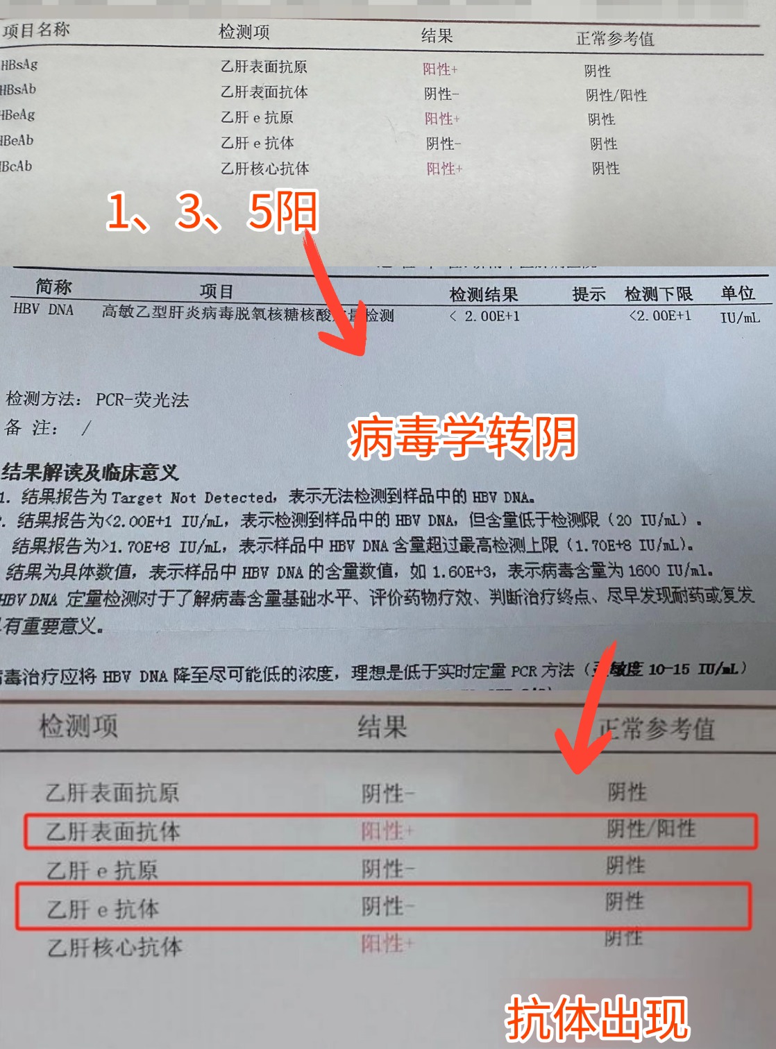 肝病挂什么科-自身免疫性肝病挂什么科