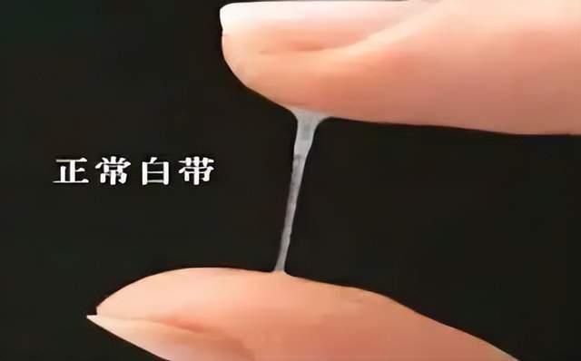 绝经后还有白带吗-绝经后还有白色分泌物吗