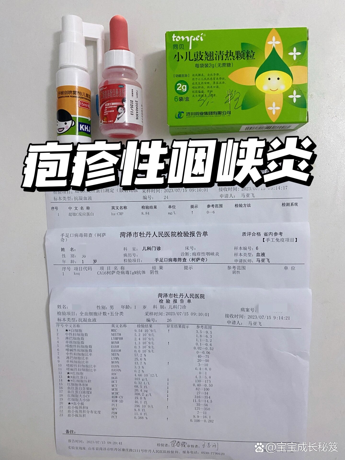 长疱疹不能吃什么-长疱疹不能吃什么水果