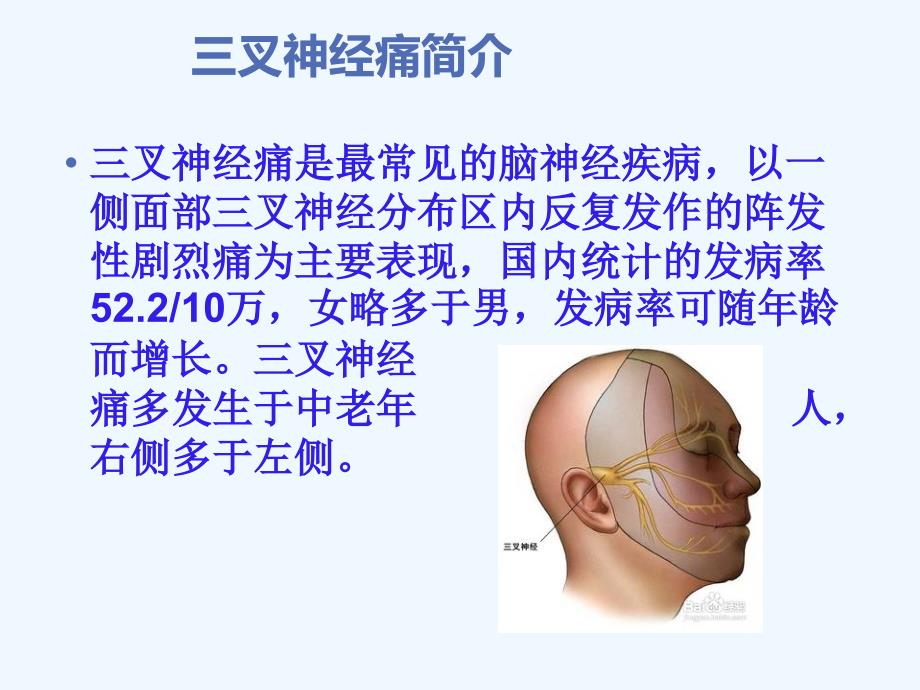 三叉神经痛治疗(三叉神经痛最好的治疗方法)