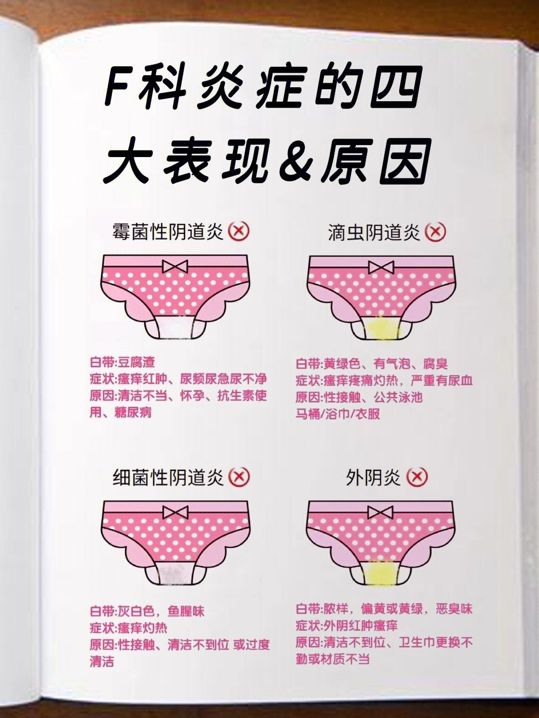 妇科炎症的症状-(女士妇科炎症的症状)